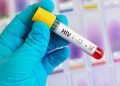 Los médicos confirman la segunda curación del mundo de un paciente con VIH