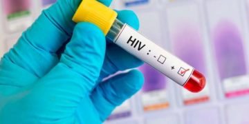 Los médicos confirman la segunda curación del mundo de un paciente con VIH
