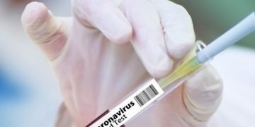 Aumentan a 6,135 casos positivos