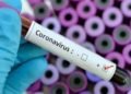 Médicos con execuátur pueden indicar la prueba de coronavirus
