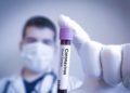 Alemania ha practicado un millón de test de la COVID-19, el 90% negativos