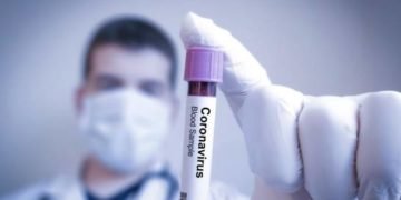 Alemania ha practicado un millón de test de la COVID-19, el 90% negativos
