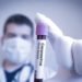 Alemania ha practicado un millón de test de la COVID-19, el 90% negativos