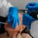 El 21.1% de los casos de coronavirus está en cuidados intensivos