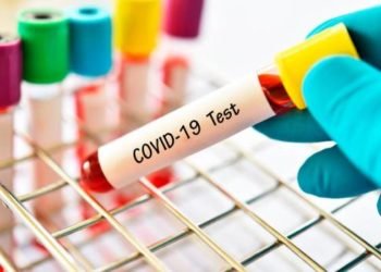 Más de 395,000 muertos en el mundo por coronavirus