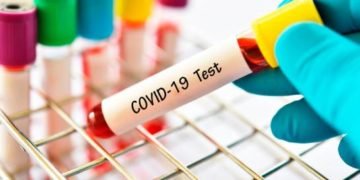 Más de 395,000 muertos en el mundo por coronavirus