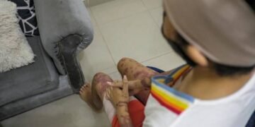 Yocairy: “Quiero pedirle al presidente Abinader que me ayude con mi cirugía en la cara”