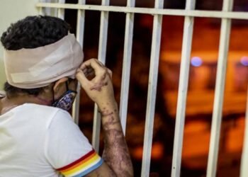 El presidente Abinader ayudará a Yocairy con sus cirugías reconstructivas