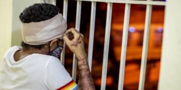 El presidente Abinader ayudará a Yocairy con sus cirugías reconstructivas