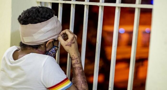 El presidente Abinader ayudará a Yocairy con sus cirugías reconstructivas