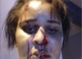 La periodista golpeada por un “Policía Abusador” es acusada de asalto por la policía