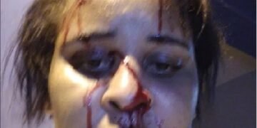 La periodista golpeada por un “Policía Abusador” es acusada de asalto por la policía
