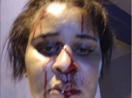 La periodista golpeada por un “Policía Abusador” es acusada de asalto por la policía