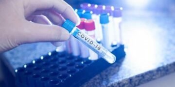 Cinco muertes y 788 nuevos casos de coronavirus se reportan este miércoles