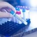 Cinco muertes y 788 nuevos casos de coronavirus se reportan este miércoles