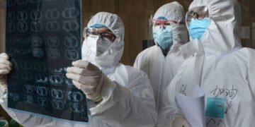 Entre 2000-2019: Principales causas de muerte y discapacidad en el mundo