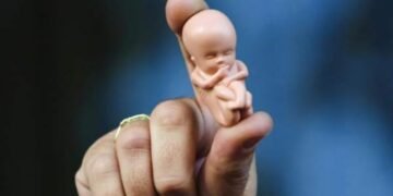 El acceso al aborto en el mundo, unas normas muy dispares según los países