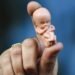 El acceso al aborto en el mundo, unas normas muy dispares según los países