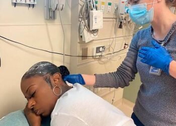 Mujer que se fijó el pelo con pegamento tendrá que operarse