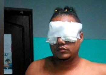 Médicos podrían salvar un ojo a joven atacado con tijeras