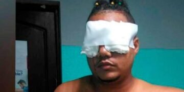 Médicos podrían salvar un ojo a joven atacado con tijeras