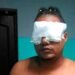 Médicos podrían salvar un ojo a joven atacado con tijeras