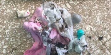 Recién nacida resultó con quemaduras tras incendio en hospital en Hato Mayor