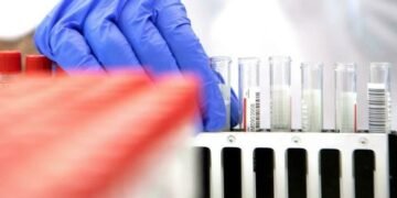 Científicos chinos presentan nuevo test anticovid ultrarrápido