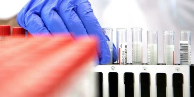 Científicos chinos presentan nuevo test anticovid ultrarrápido