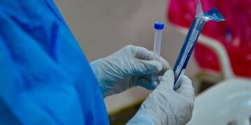 Salud Pública reporta 63 nuevos contagios de COVID-19 y 301 casos activos