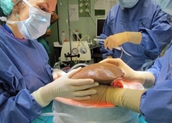 Exitoso trasplante hígado humano tratado 3 días fuera del cuerpo
