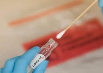 Salud Pública reporta 731 casos activos de COVID-19