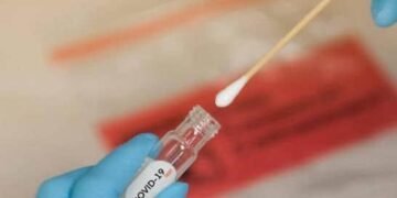 Salud Pública reporta 731 casos activos de COVID-19