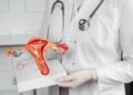 Tasa de mortalidad del cáncer cervicouterino es tres veces más alta en América Latina