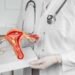 Tasa de mortalidad del cáncer cervicouterino es tres veces más alta en América Latina