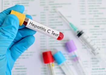 Hepatitis, más letal que la malaria, la tuberculosis y el sida