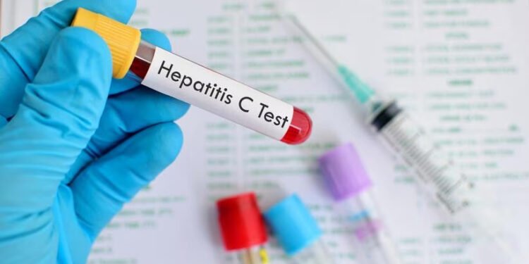 Hepatitis, más letal que la malaria, la tuberculosis y el sida