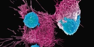 Inmunoterapia CAR-T ataca cáncer ovario en ratones con una dosis