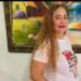 Fallece mujer que fue quemada por expareja en Salcedo