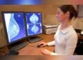 Atención multidisciplinaria: un modelo centralizado que acelera el diagnóstico temprano del cáncer